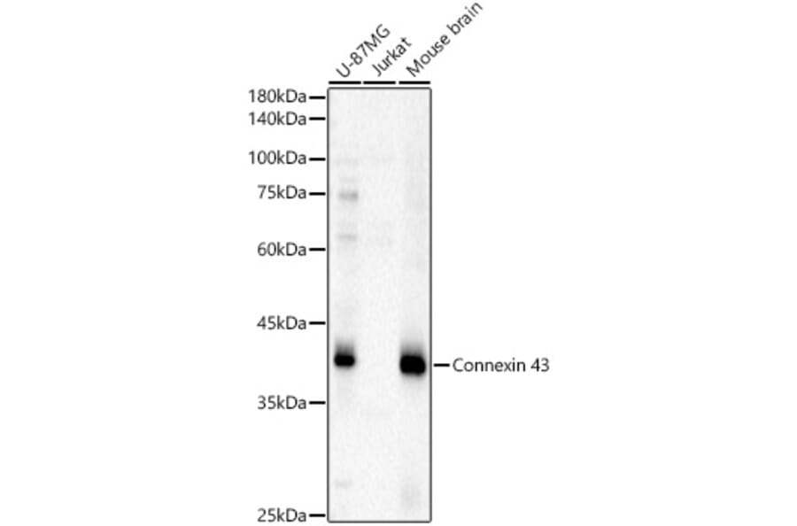 Western Blot - Anti-Connexin 43/GJA1 Antibody (A13923) - Antibodies.com