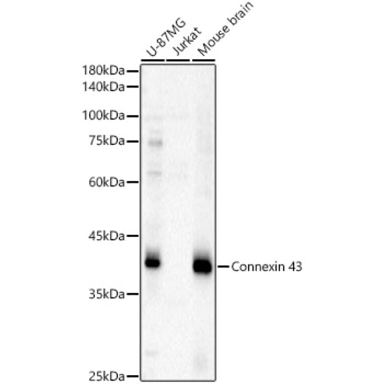 Western Blot - Anti-Connexin 43/GJA1 Antibody (A13923) - Antibodies.com