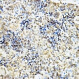Immunohistochemistry - Anti-Glucocorticoid Receptor Antibody (A13924) - Antibodies.com