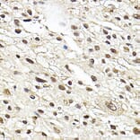Immunohistochemistry - Anti-Glucocorticoid Receptor Antibody (A13924) - Antibodies.com