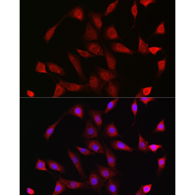 Immunofluorescence - Anti-Glucocorticoid Receptor Antibody (A13924) - Antibodies.com