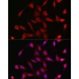 Immunofluorescence - Anti-Glucocorticoid Receptor Antibody (A13924) - Antibodies.com