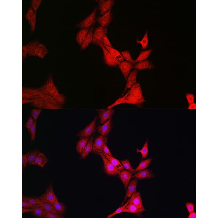 Immunofluorescence - Anti-Glucocorticoid Receptor Antibody (A13924) - Antibodies.com