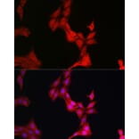 Immunofluorescence - Anti-Glucocorticoid Receptor Antibody (A13924) - Antibodies.com