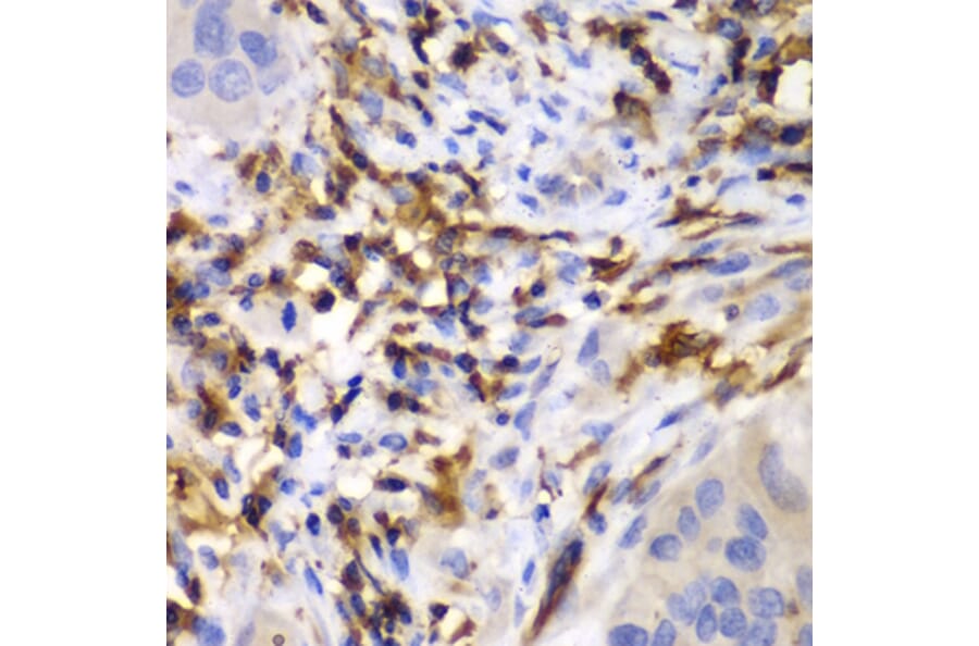 Immunohistochemistry - Anti-HCLS1 Antibody (A13925) - Antibodies.com