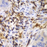 Immunohistochemistry - Anti-HCLS1 Antibody (A13925) - Antibodies.com