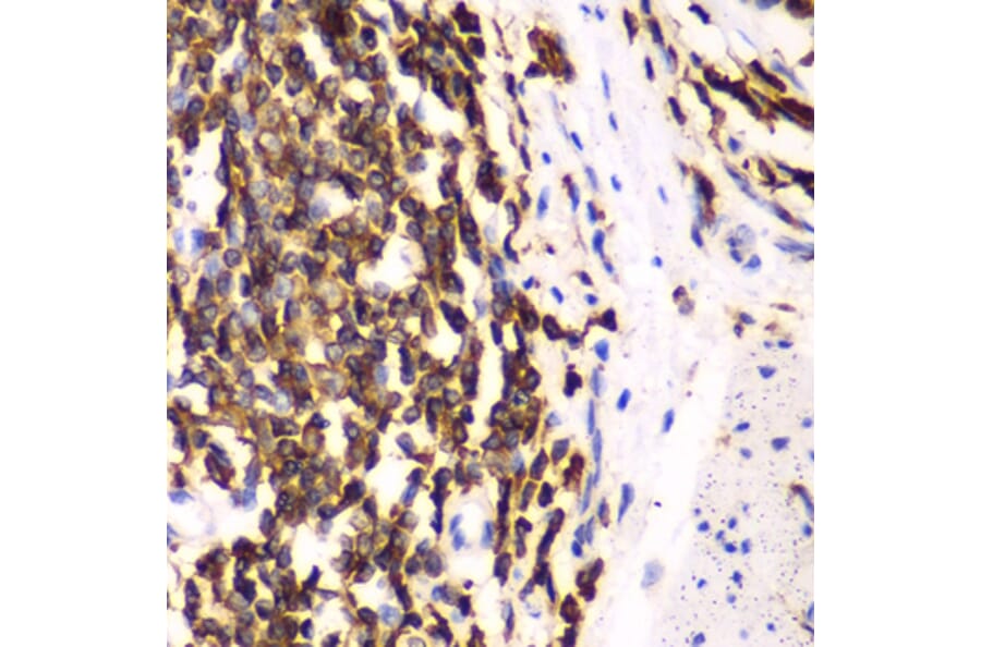 Immunohistochemistry - Anti-HCLS1 Antibody (A13925) - Antibodies.com