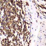 Immunohistochemistry - Anti-HCLS1 Antibody (A13925) - Antibodies.com