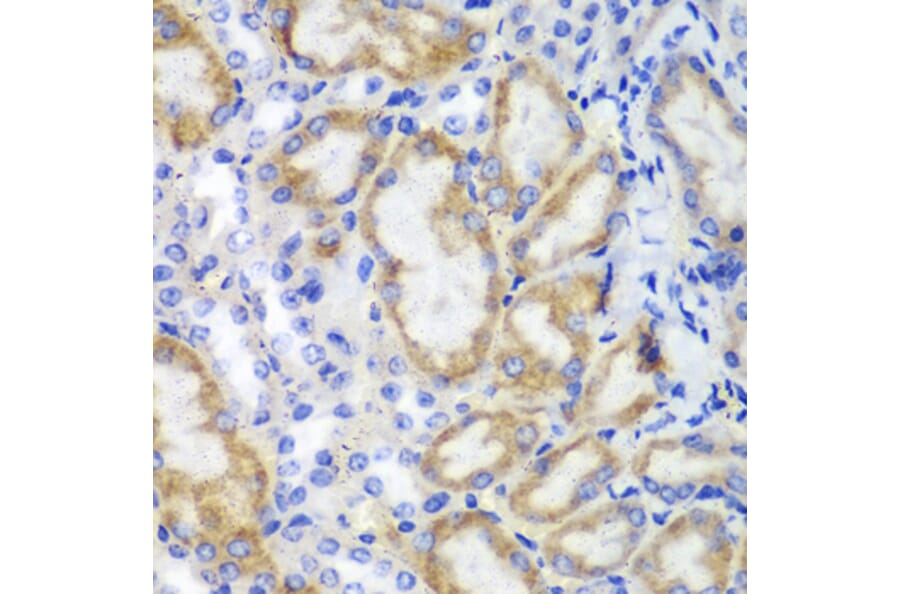 Immunohistochemistry - Anti-HCLS1 Antibody (A13925) - Antibodies.com