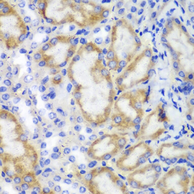 Immunohistochemistry - Anti-HCLS1 Antibody (A13925) - Antibodies.com