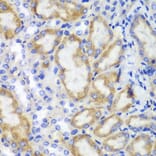 Immunohistochemistry - Anti-HCLS1 Antibody (A13925) - Antibodies.com