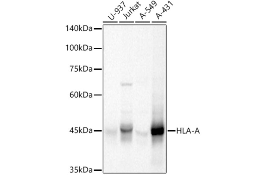Western Blot - Anti-HLA-A Antibody (A13926) - Antibodies.com