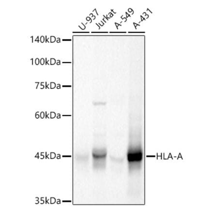 Western Blot - Anti-HLA-A Antibody (A13926) - Antibodies.com