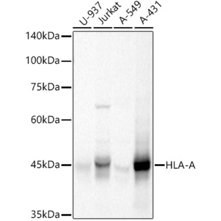 Western Blot - Anti-HLA-A Antibody (A13926) - Antibodies.com