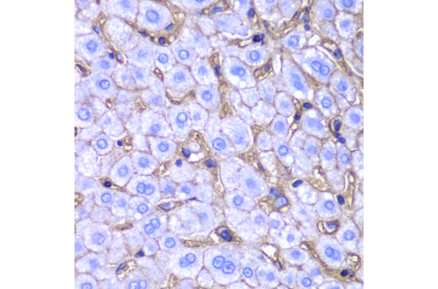 Immunohistochemistry - Anti-HLA-A Antibody (A13926) - Antibodies.com