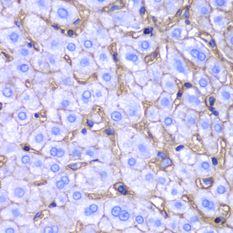 Immunohistochemistry - Anti-HLA-A Antibody (A13926) - Antibodies.com
