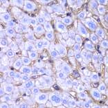 Immunohistochemistry - Anti-HLA-A Antibody (A13926) - Antibodies.com