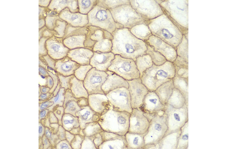 Immunohistochemistry - Anti-HLA-A Antibody (A13926) - Antibodies.com