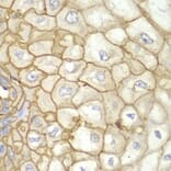 Immunohistochemistry - Anti-HLA-A Antibody (A13926) - Antibodies.com