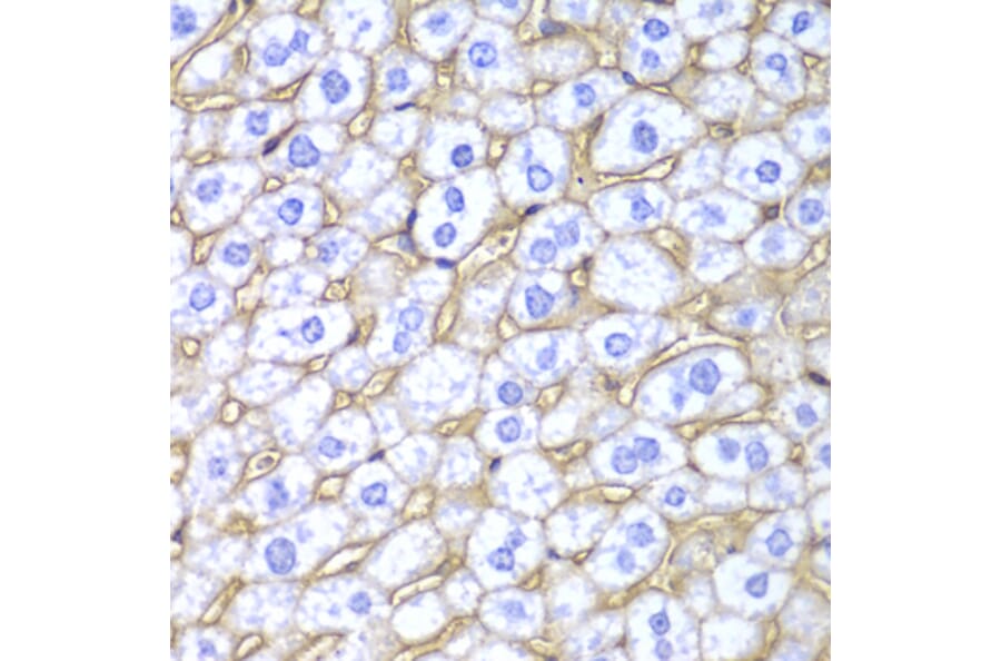 Immunohistochemistry - Anti-HLA-A Antibody (A13926) - Antibodies.com