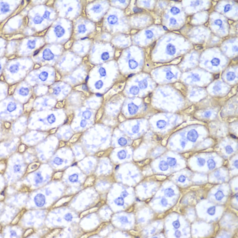 Immunohistochemistry - Anti-HLA-A Antibody (A13926) - Antibodies.com