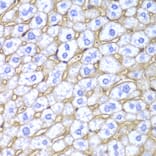 Immunohistochemistry - Anti-HLA-A Antibody (A13926) - Antibodies.com