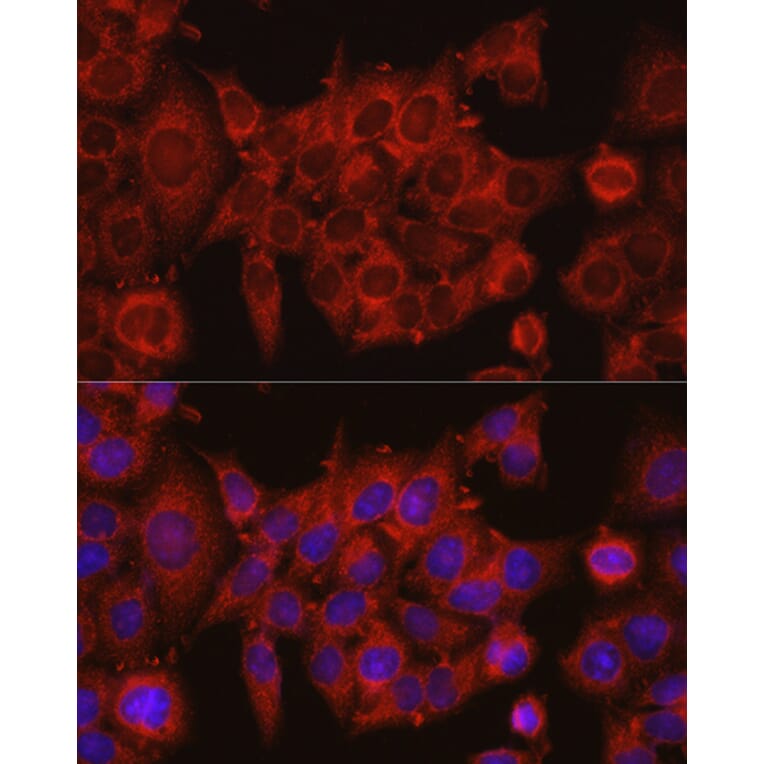 Immunofluorescence - Anti-IDH1 Antibody (A13927) - Antibodies.com