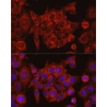 Immunofluorescence - Anti-IDH1 Antibody (A13927) - Antibodies.com