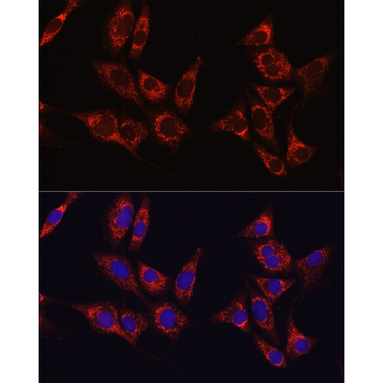 Immunofluorescence - Anti-IDH1 Antibody (A13927) - Antibodies.com