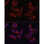 Immunofluorescence - Anti-IDH1 Antibody (A13927) - Antibodies.com