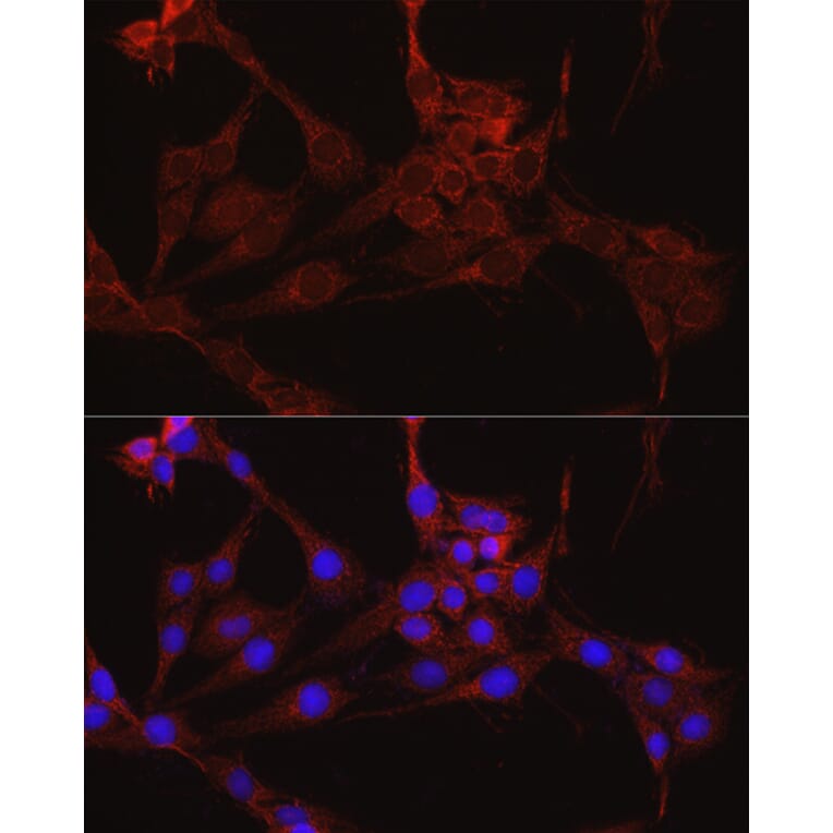 Immunofluorescence - Anti-IDH1 Antibody (A13927) - Antibodies.com