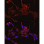 Immunofluorescence - Anti-IDH1 Antibody (A13927) - Antibodies.com