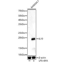 Western Blot - Anti-IL-10 Antibody (A13928) - Antibodies.com