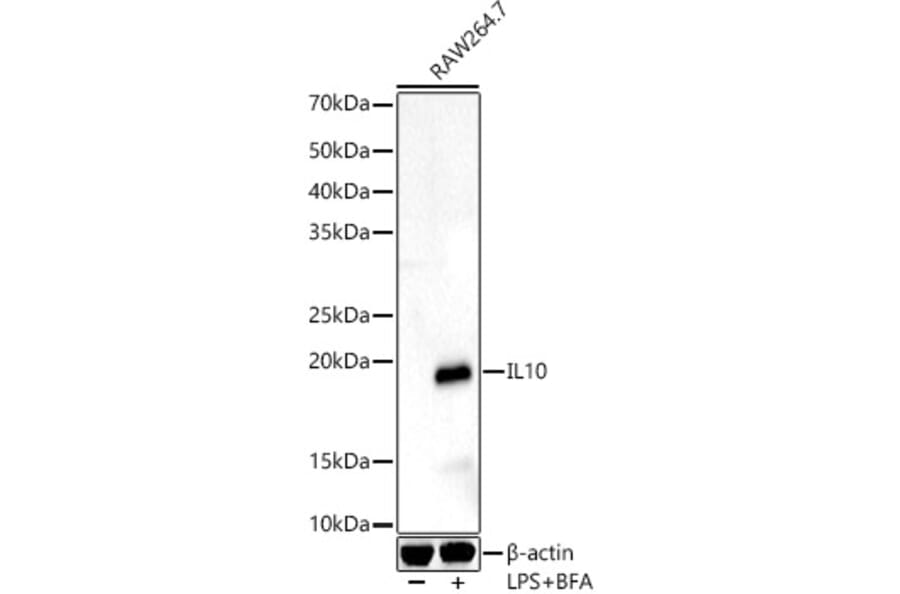 Western Blot - Anti-IL-10 Antibody (A13928) - Antibodies.com
