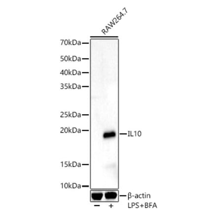 Western Blot - Anti-IL-10 Antibody (A13928) - Antibodies.com