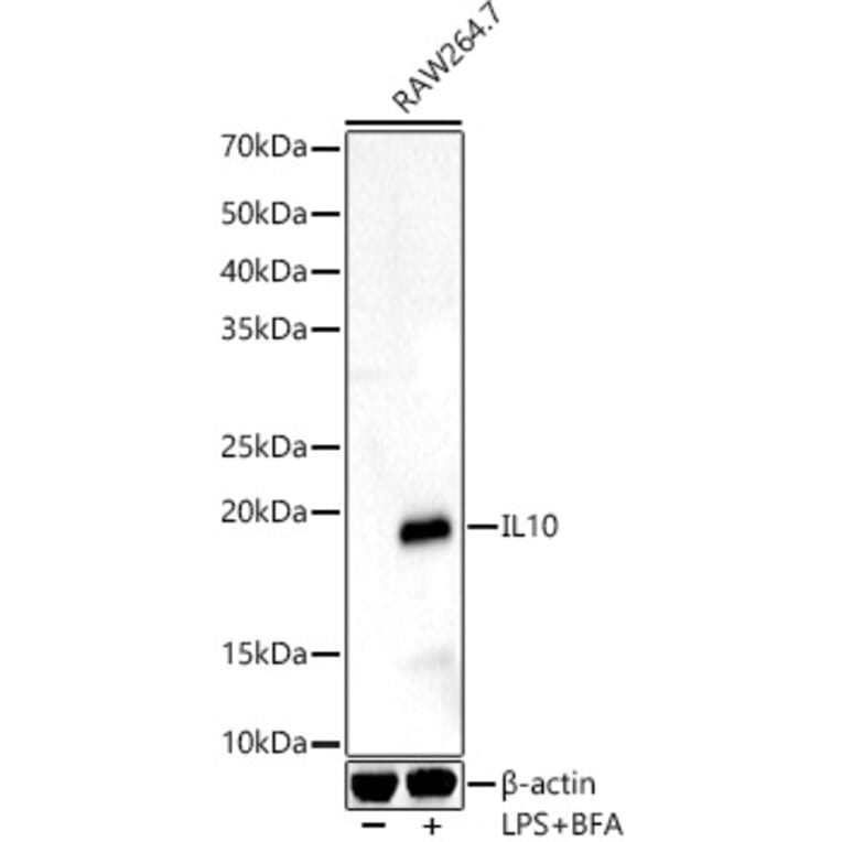 Western Blot - Anti-IL-10 Antibody (A13928) - Antibodies.com