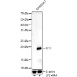 Western Blot - Anti-IL-10 Antibody (A13928) - Antibodies.com