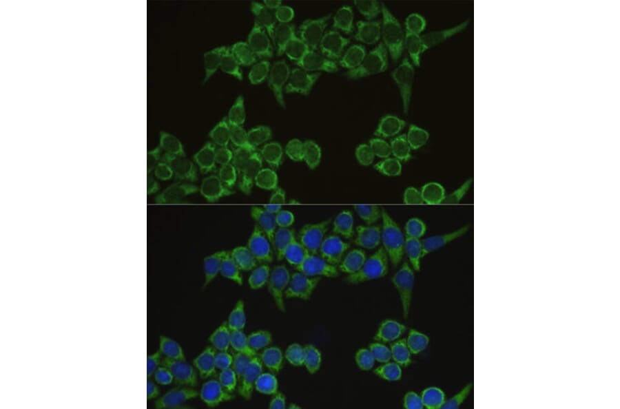 Immunofluorescence - Anti-IRF3 Antibody (A2172) - Antibodies.com