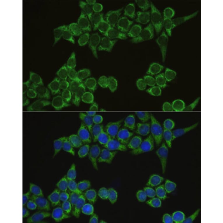 Immunofluorescence - Anti-IRF3 Antibody (A2172) - Antibodies.com