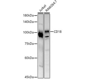 Western Blot - Anti-CD18 Antibody (A13930) - Antibodies.com