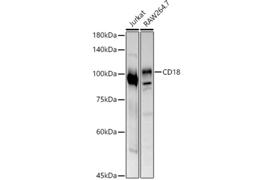 Western Blot - Anti-CD18 Antibody (A13930) - Antibodies.com