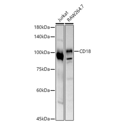 Western Blot - Anti-CD18 Antibody (A13930) - Antibodies.com