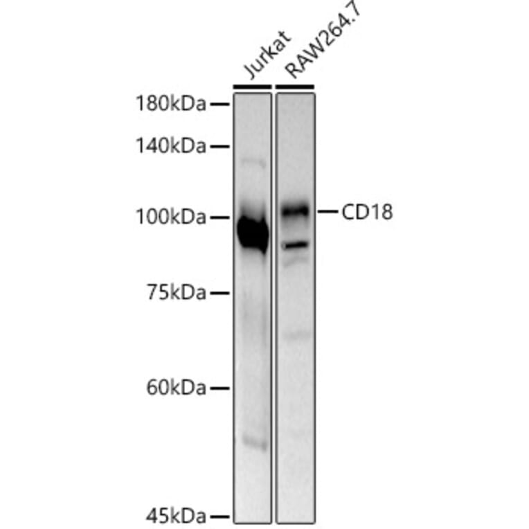 Western Blot - Anti-CD18 Antibody (A13930) - Antibodies.com