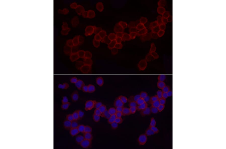 Immunofluorescence - Anti-CD18 Antibody (A13930) - Antibodies.com