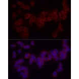 Immunofluorescence - Anti-CD18 Antibody (A13930) - Antibodies.com