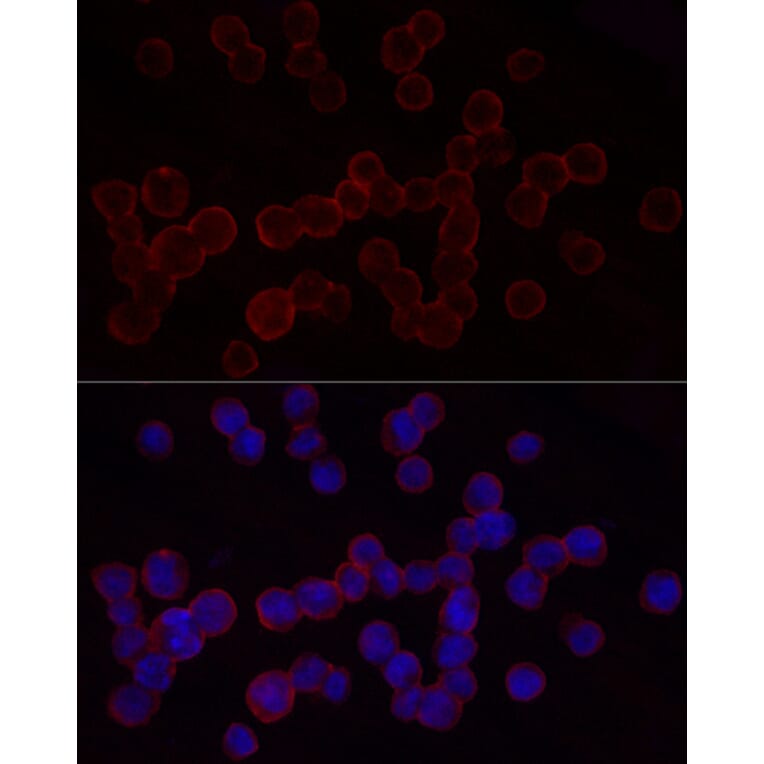 Immunofluorescence - Anti-CD18 Antibody (A13930) - Antibodies.com