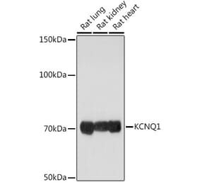Western Blot - Anti-KCNQ1 Antibody (A13931) - Antibodies.com