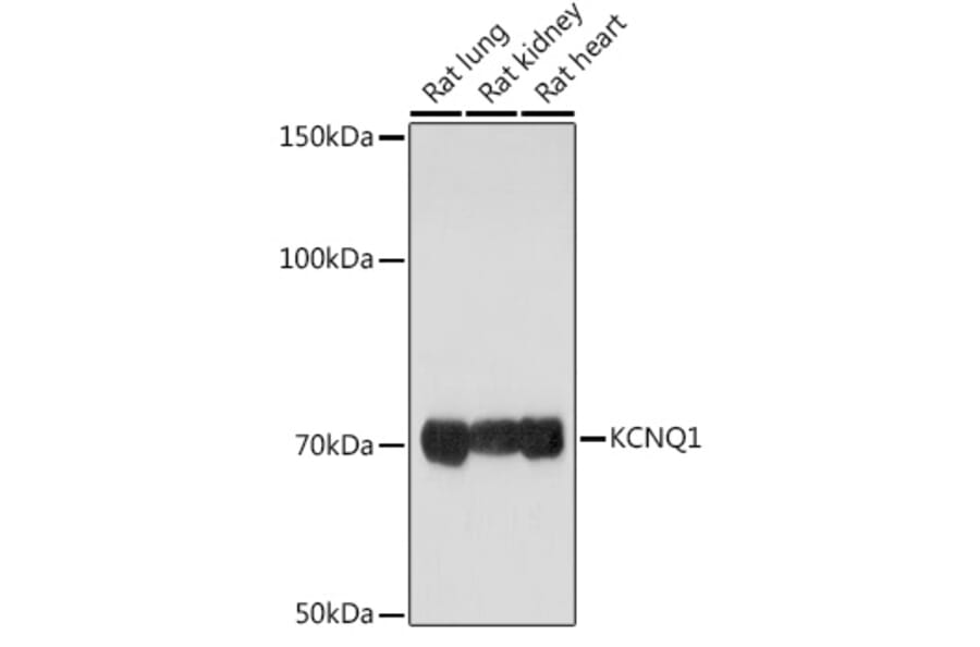 Western Blot - Anti-KCNQ1 Antibody (A13931) - Antibodies.com