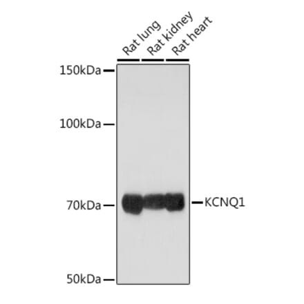 Western Blot - Anti-KCNQ1 Antibody (A13931) - Antibodies.com