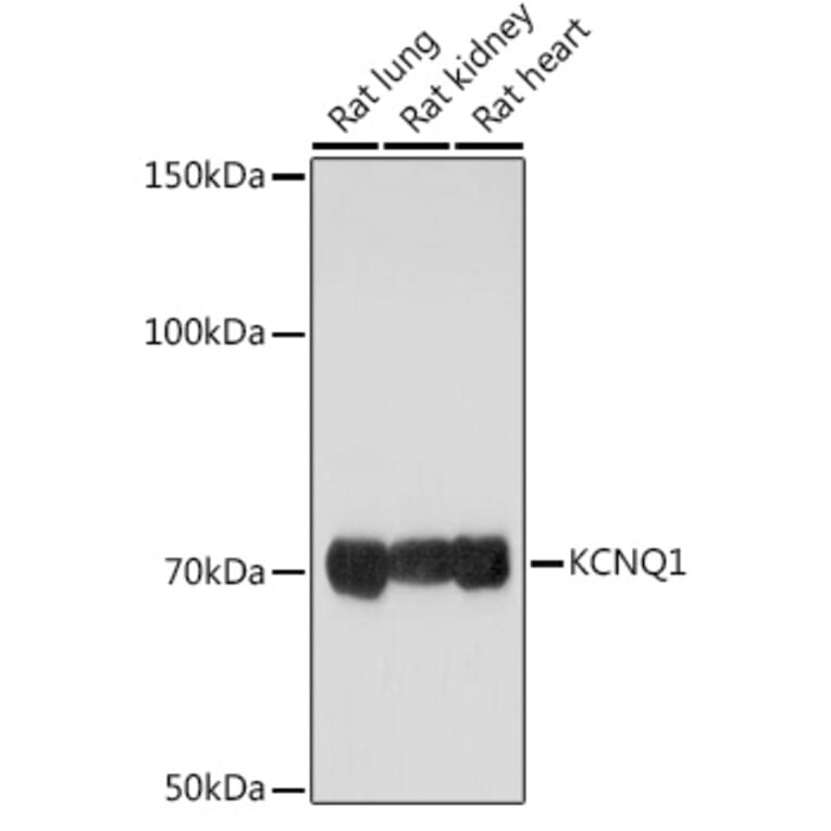 Western Blot - Anti-KCNQ1 Antibody (A13931) - Antibodies.com